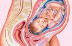 Беременность двойней: от первых признаков до родов 30 недель двойня очень больно растет живот
